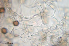 04_m_Physarum_album_20090809S03_4108_OBR