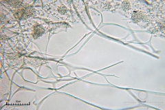 05_m_Physarum_album_20090809S03_4106_OBR