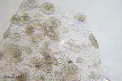 06_m_Physarum_album_20090809S03_4097_OBR