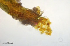 06_m_Physarum_viride_var_aurantium_20090809S02_4084_OBR