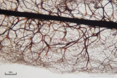 08_Stemonitis_axifera_20100620S01_S6307179_obr