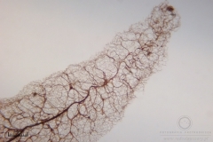 09_Stemonitis_axifera_20100620S01_S6307181_obr