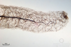 10_Stemonitis_axifera_20100620S01_S6307175_obr
