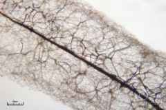 04_m_Stemonitis_fusca_20090702S05_4054_OBR