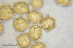 01_m_Trichia_affinis_20090912S02_4214_OBR