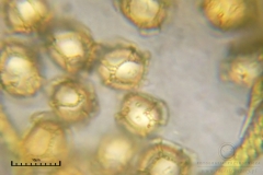 02_m_Trichia_affinis_20090912S02_4211_OBR