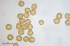 03_m_Trichia_affinis_20090912S02_4198_OBR