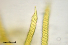04_m_Trichia_affinis_20090912S02_4205_OBR