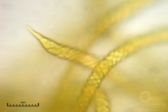 05_m_Trichia_affinis_20090912S02_4204_OBR