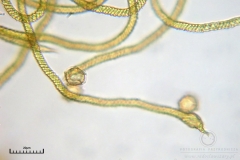 06_m_Trichia_affinis_20090912S02_4200_OBR