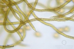 07_m_Trichia_affinis_20090912S02_4199_OBR
