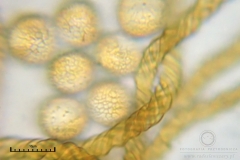 01_m_Trichia_decipiens_20091126S01_4272_OBR