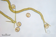 04_m_Trichia_decipiens_20091126S01_4286_OBR