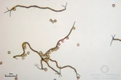 05_m_Trichia_decipiens_20091126S01_4283_OBR