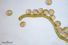 06_m_Trichia_decipiens_20091126S01_4282_OBR
