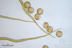 07_m_Trichia_decipiens_20091126S01_4279_OBR