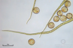 08_m_Trichia_decipiens_20091126S01_4276_OBR
