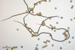 09_m_Trichia_decipiens_20091126S01_4274_OBR