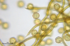 05_m_Trichia_persimilis_20091108S02_4263_OBR