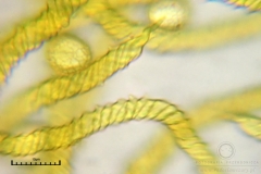 01_m_Trichia_scabra_20090809S07_4172_OBR