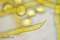 02_m_Trichia_scabra_20090809S07_4169_OBR