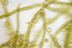 04_m_Trichia_scabra_20090809S07_4173_OBR
