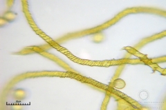 05_m_Trichia_scabra_20090809S07_4162_OBR