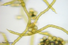 06_m_Trichia_scabra_20090809S07_4161_OBR