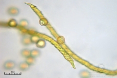 07_m_Trichia_scabra_20090809S07_4158_OBR