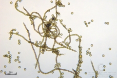 08_m_Trichia_scabra_20090809S07_4160_OBR